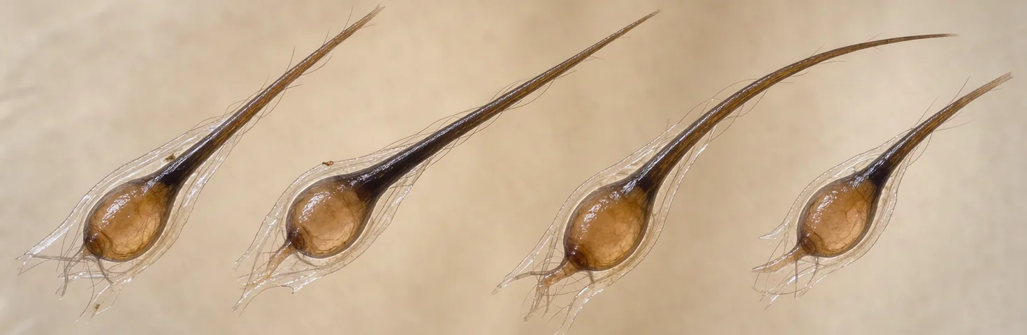 Illustrative microscopy view of isolated hair follicles with attached hair fibres.